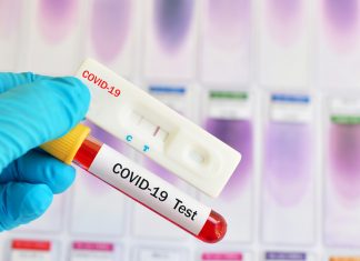 Тест на ковид – где сдавать в Киеве и сколько стоит